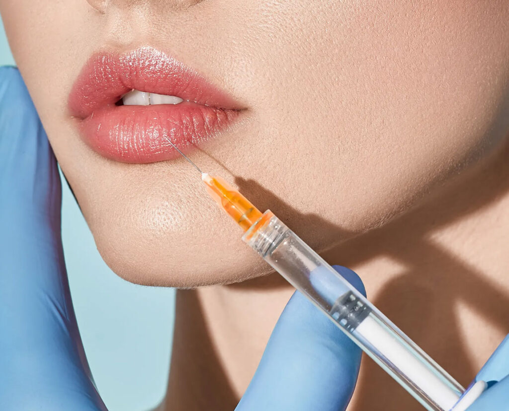 Lip filler injection needle