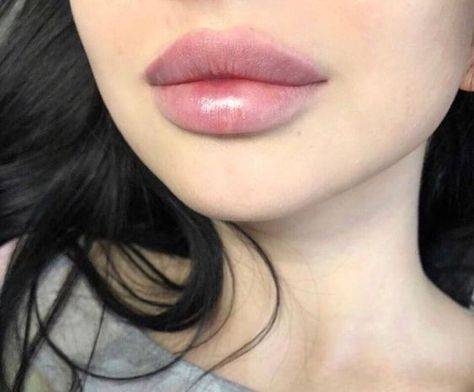 lip injections on big lips