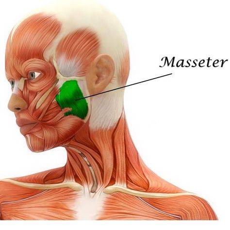 masseter muscle botox