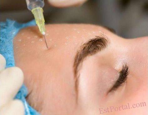 mesoterapia facial