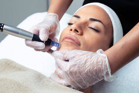 mesoterapia facial