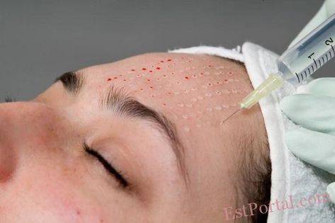 mesoterapia facial