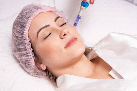 mesoterapia facial