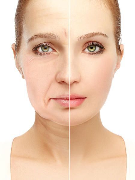 Mesotherapy Before After Face Results