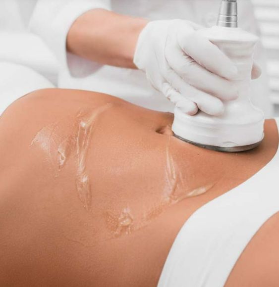 Mesotherapy Fat Melting