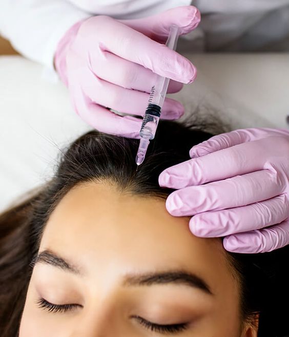 Mesotherapy for Hair Loss