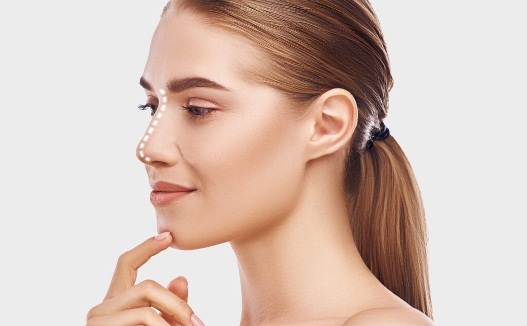 Nose Thread Lift Permanent