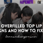 Overfilled Top Lip: Signs and How to Fix It