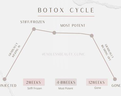 preventative botox