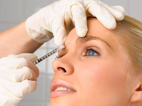 preventative botox