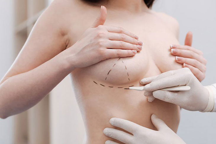 risks of breast augmentation