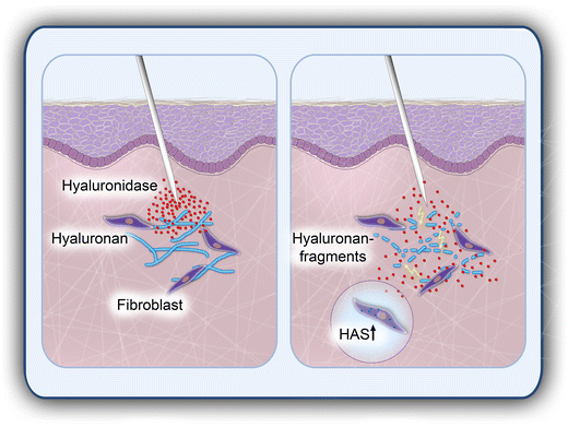 Role of Hyaluronidase