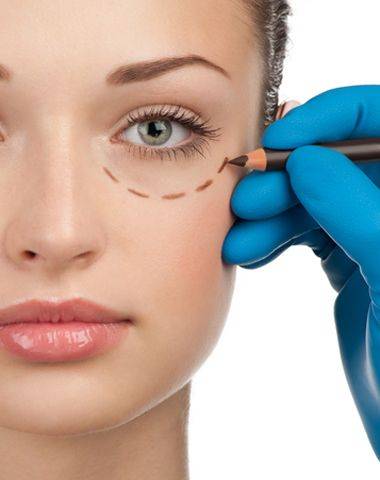 Smile eye surgery