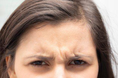 Squintmaxxing Wrinkles: The Impact of Squinting on Your Skin