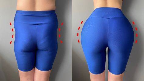 sudden indentation on buttock