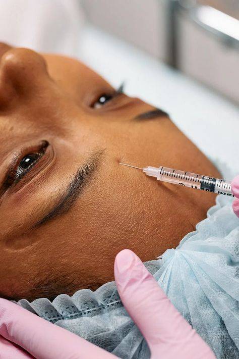 botox treatment