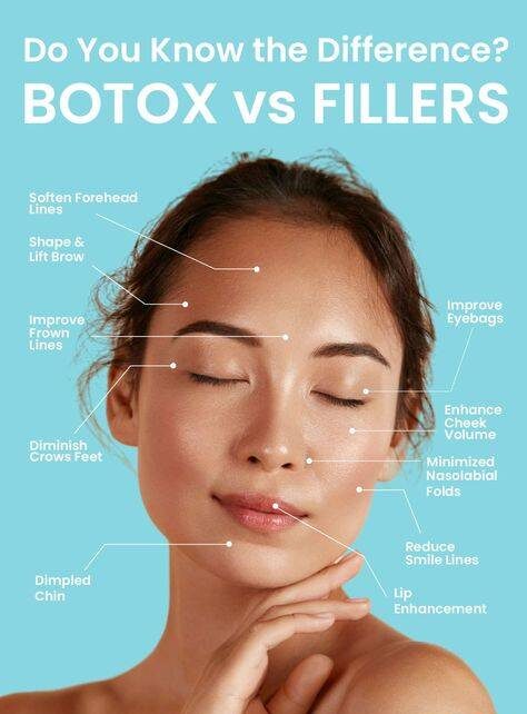 botox treatment