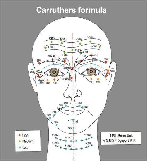 botox injections