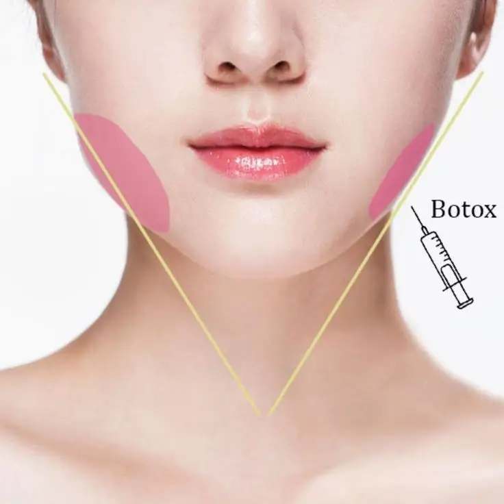 Understanding Dermal Fillers for Breasts