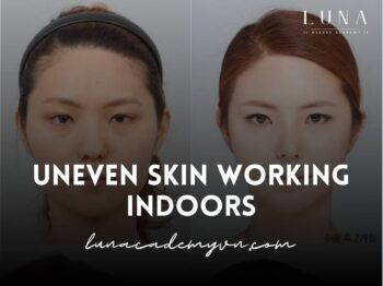 uneven skin working indoors