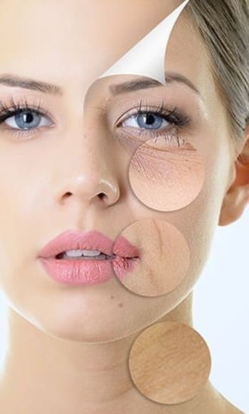 What Are Facial Filler and Botox Classes?