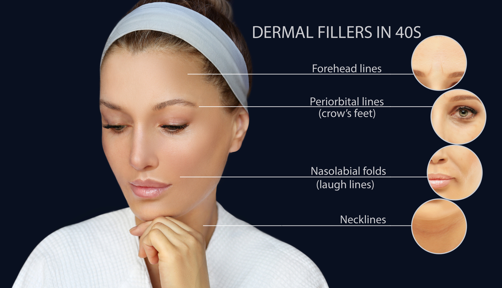 What is a Facial Filler Course?