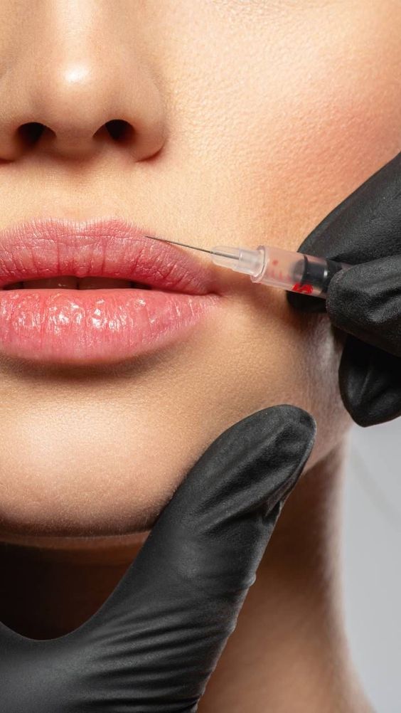 What is a Lip Filler Course