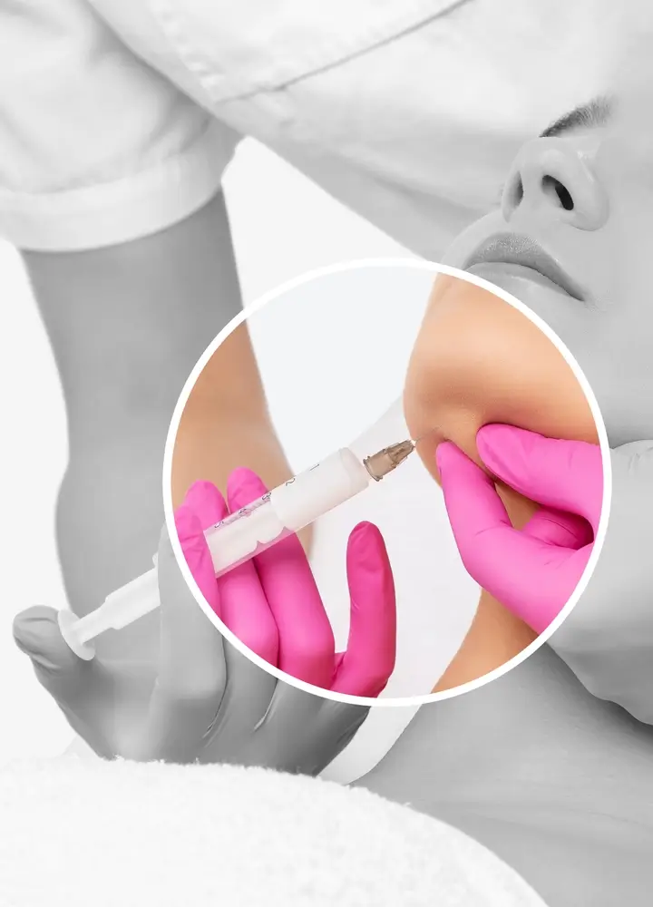 What is Mesotherapy