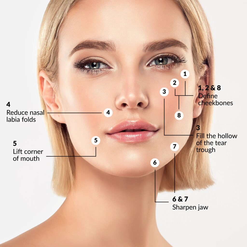 What is the 8 Point Filler Facelift?