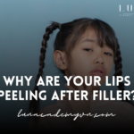 Why Are Your Lips Peeling After Filler?