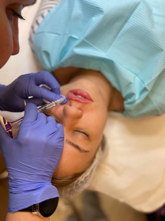 Why Beginners Should Consider a Lip Filler Course