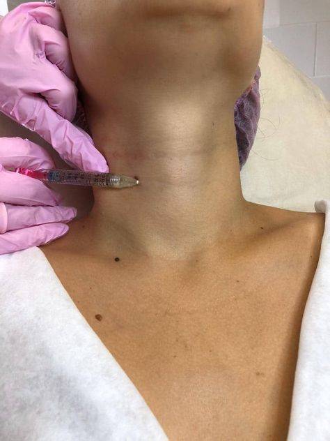 Female neck