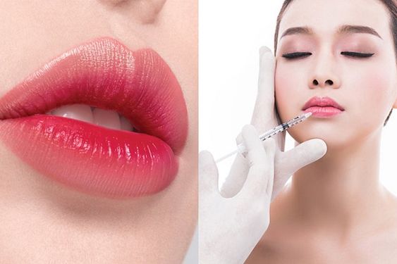 Why Should You Take a Lip Filler Course for Non-Medics?