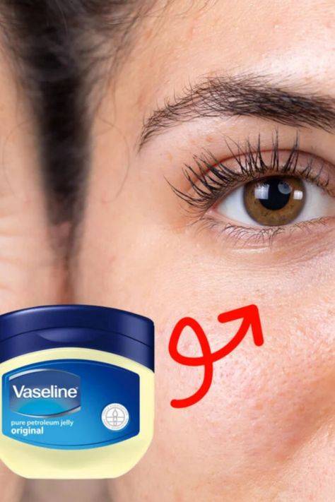 Will vaseline help with wrinkles