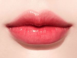 Long-Term Implications of Lip Fillers