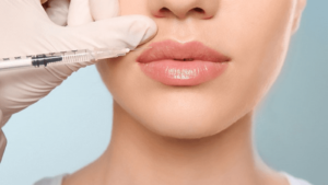 Maintaining Your Lip Filler Results