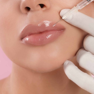 Understanding Lip Fillers for Thin Lips