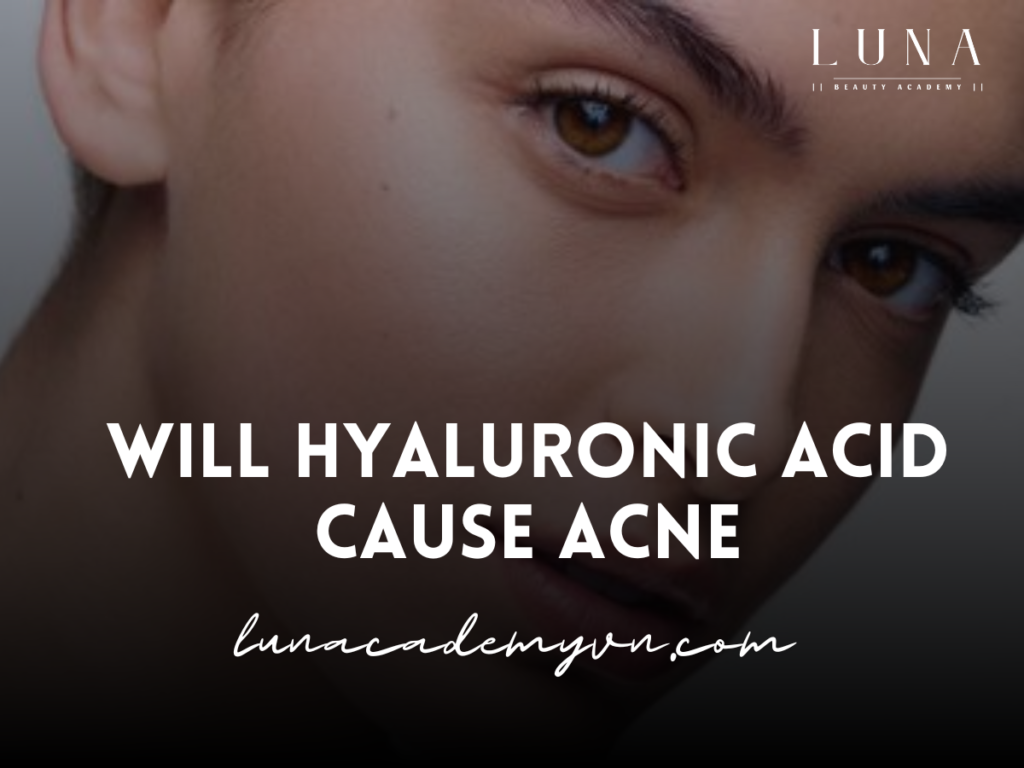 Will Hyaluronic Acid Cause Acne