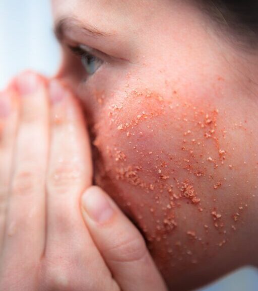 Avoid Exfoliation and Active Ingredients