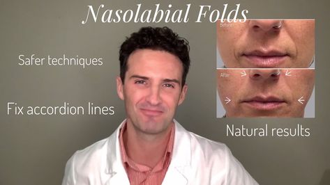 Bad Nasolabial Fold Filler: The Pitfalls, How to Avoid Them