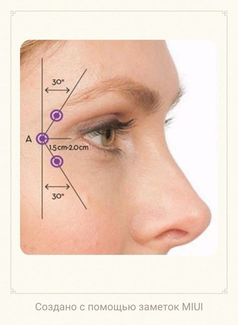 Best Filler for Nasolabial Folds