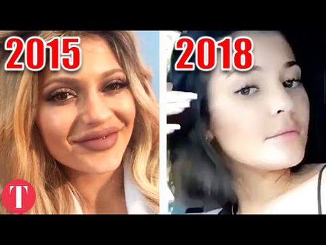 Botched Celebs: Celebrities Who Took Plastic Surgery Too Far