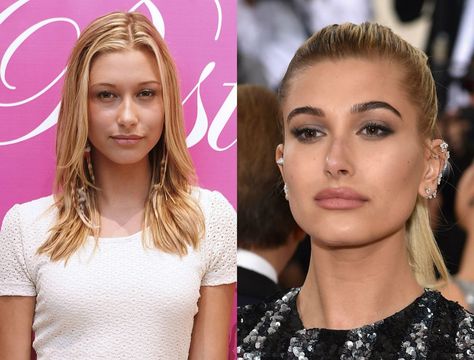 Botched Celebs: Celebrities Who Took Plastic Surgery Too Far