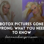 Botox Pictures Gone Wrong: What You Need to Know