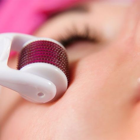 Can We Use Derma Roller Daily for Hair Growth?