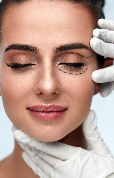 Cat Eye Face Lift: Achieving a Lifted, Alluring Look