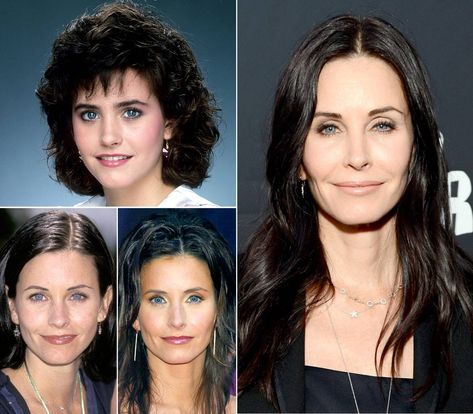 Celebrities Who Have Had a Thread Lift