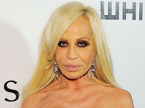 Celebrities with Botox Gone Wrong