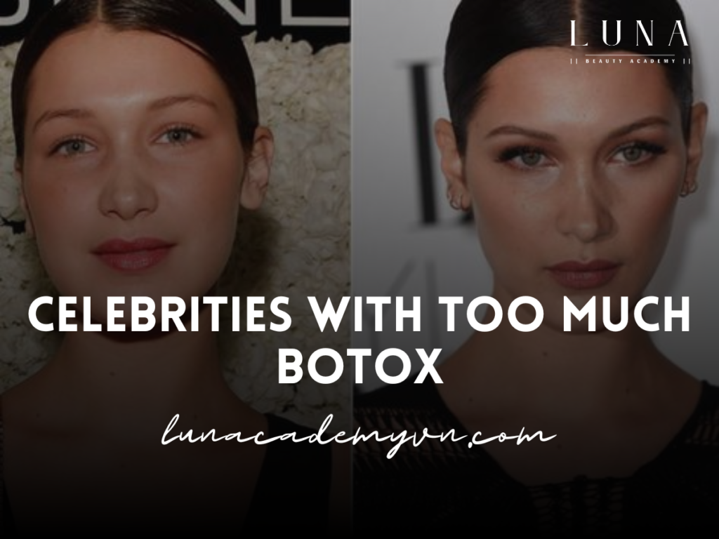 Celebrities with Too Much Botox