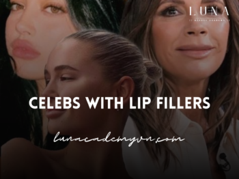 Celebs with Lip Fillers